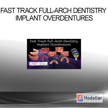 Fast Track Full-Arch Dentistry Implant Overdentures